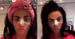 Katie Price seen with heavily bandaged face as she chats to fans about clothes