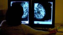 Many cancer waiting time targets set to be dropped in England