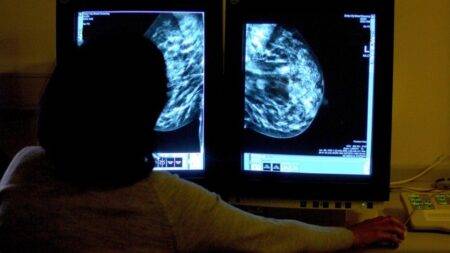 Many cancer waiting time targets set to be dropped in England