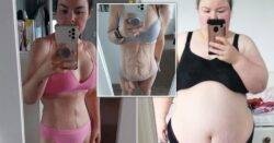 Mum has 13lbs of excess skin removed after life-changing 13 stone weight loss