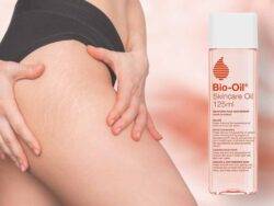 So long scars! This body oil eliminates scars and stretch marks – and it’s currently on sale