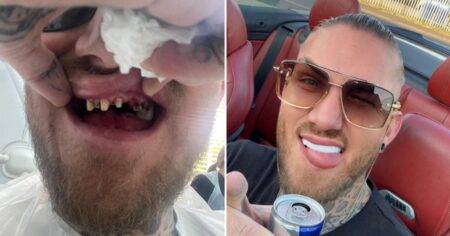 Man went to dentist 200 times after cocaine abuse and horror ops left his teeth falling out