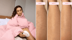 Forget laser hair removal, I’ve saved hundreds with this £136 device