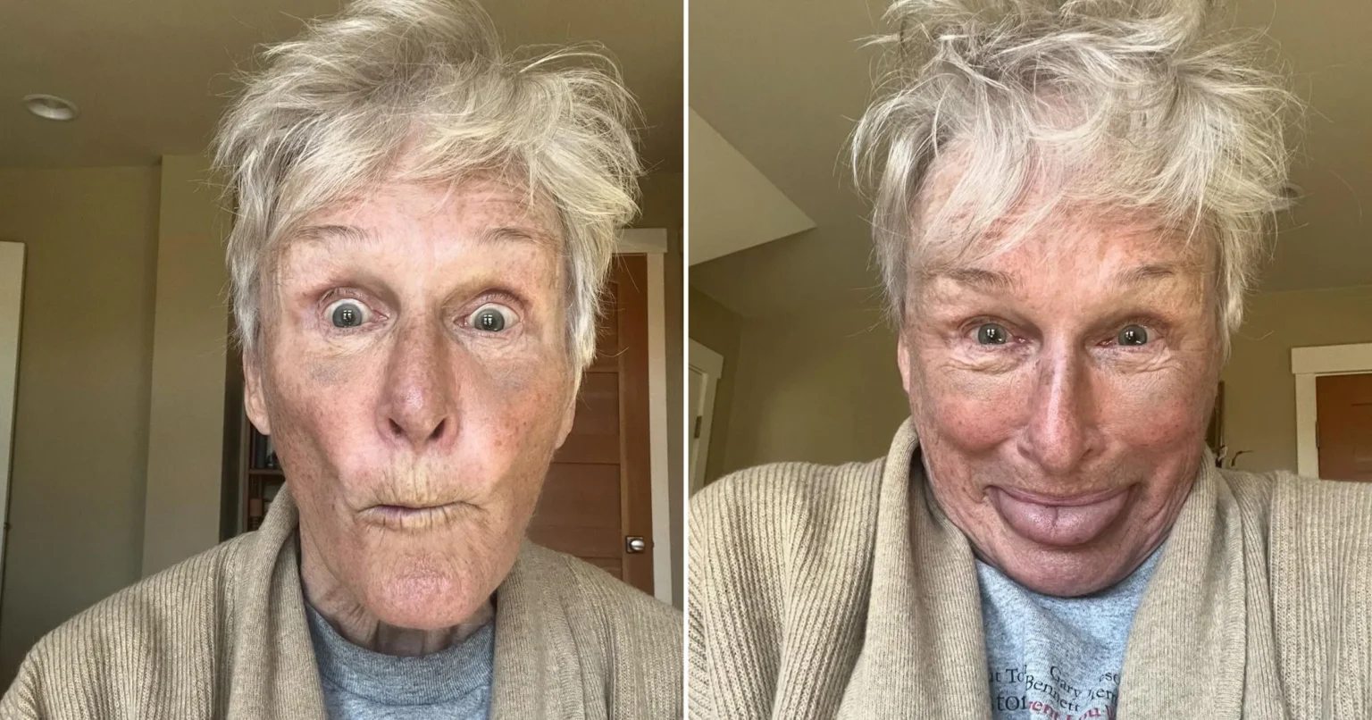 Hollywood legend, 76, shocks fans with bruised face in new selfie: ‘Feeling as beautiful as ever’