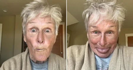 Hollywood legend, 76, shocks fans with bruised face in new selfie: ‘Feeling as beautiful as ever’