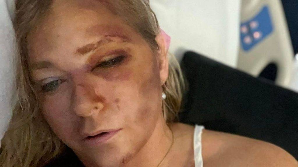 Virginia Giuffre ‘overwhelmed’ with support after saying she had days to live Virginia Giuffre ‘overwhelmed’ with support after saying she had days to live