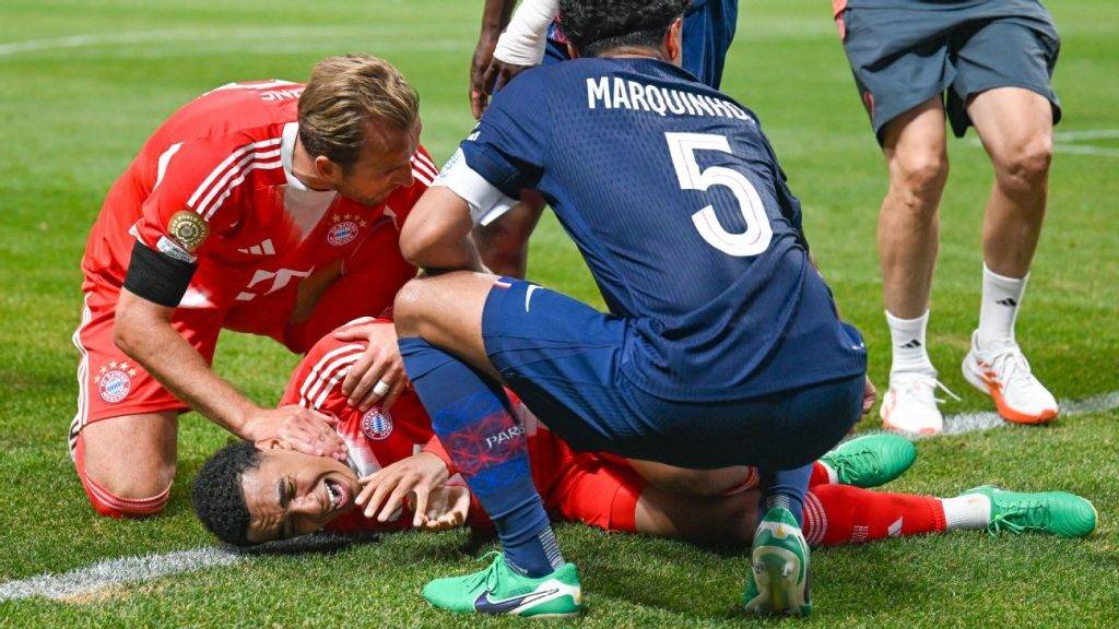 Bayern Munich’s Jamal Musiala badly injured in Club World Cup