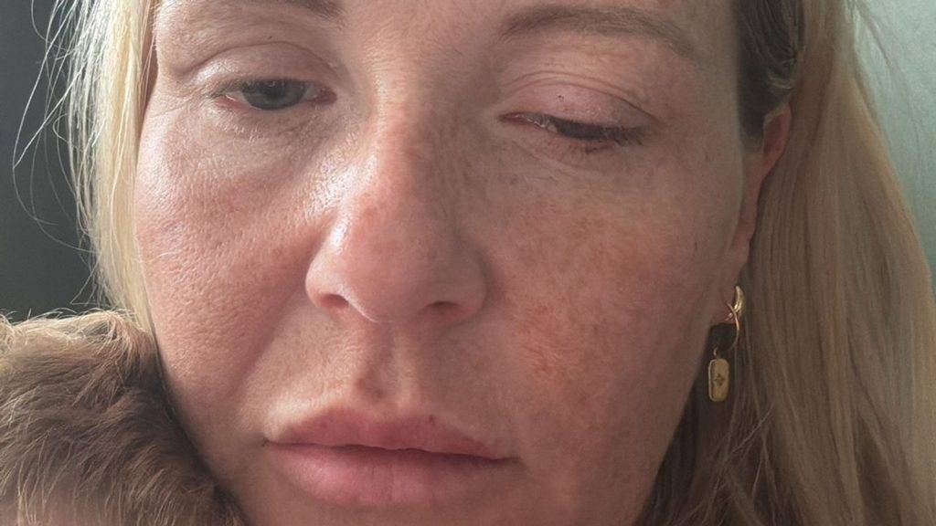 Botox-like injections spark outbreak of rare disease many doctors have never treated Botox-like injections spark outbreak of rare disease many doctors have never treated