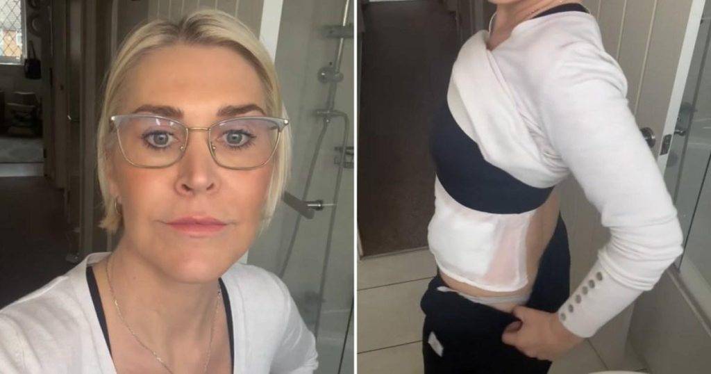 S Club star dashes to A&E after burning herself to pieces in kitchen accident