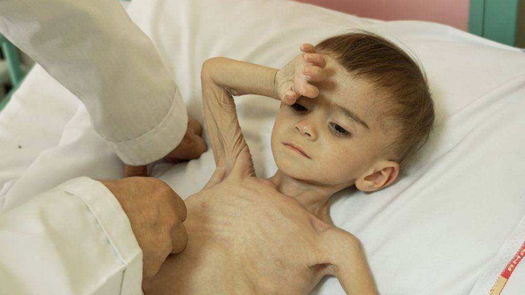 Crying babies dimmed by hunger fill this Afghanistan hospital where parents fear each day might be the last Crying babies dimmed by hunger fill this Afghanistan hospital where parents fear each day might be the last